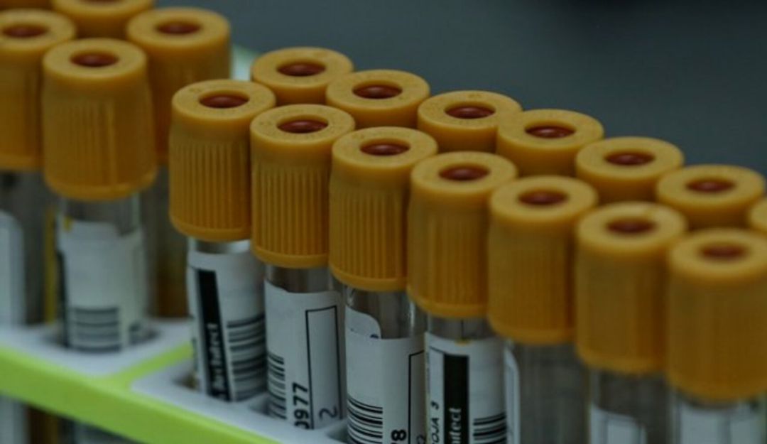 Caso de coronavirus en habitante de calle en Dosquebradas: Dosquebradas registra el primer caso de COVID-19 en habitante de calle