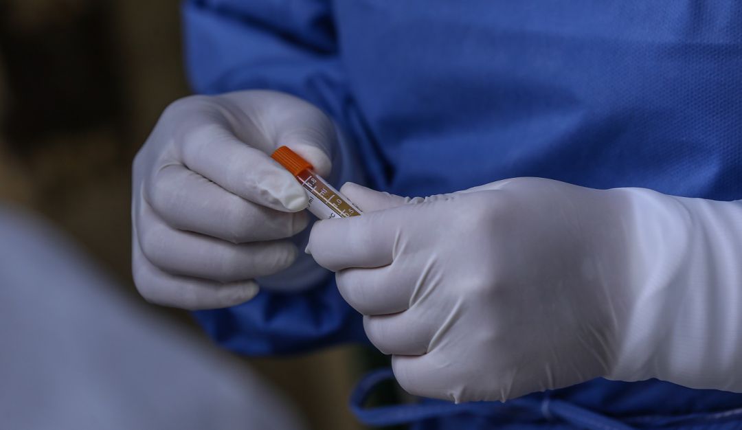 Coronavirus en Colombia Instituto Nacional Salud: "Colombia sigue presentando importaciones del COVID": INS