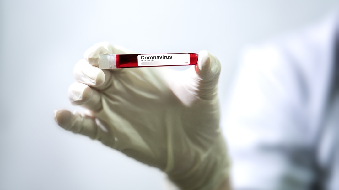 Oposición pide cuentas a Gobierno por manejo de recursos de la pandemia
