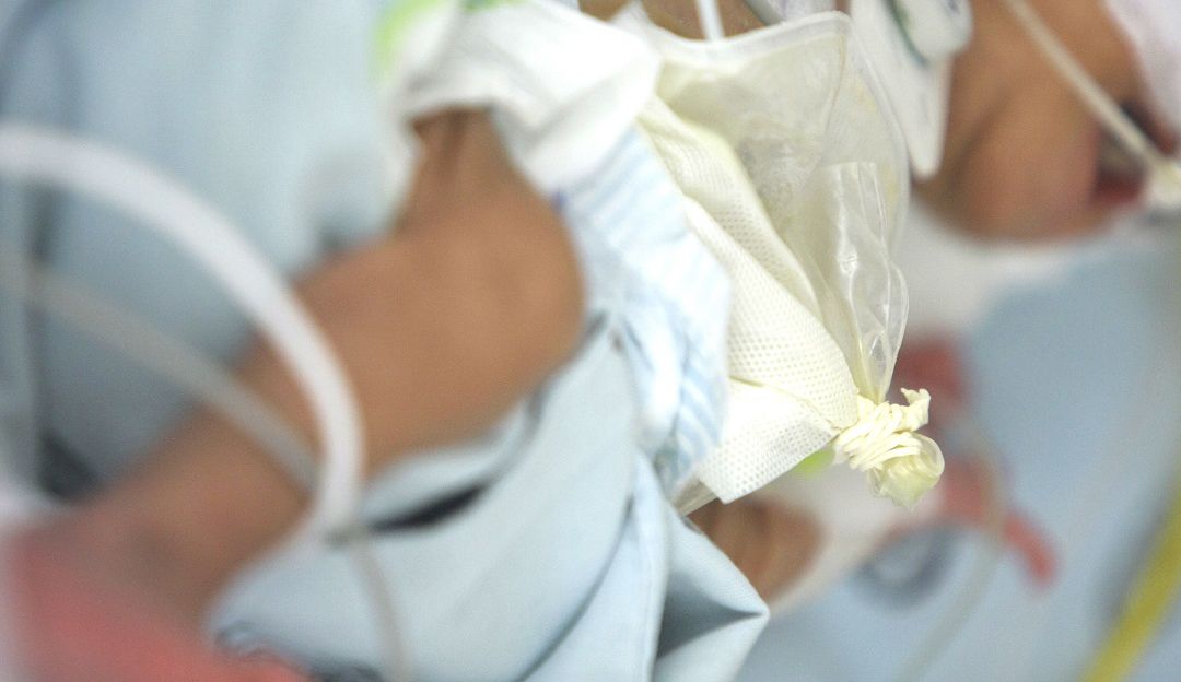 Mujer con Covid-19 dió a luz mientras permanecía en estado de coma