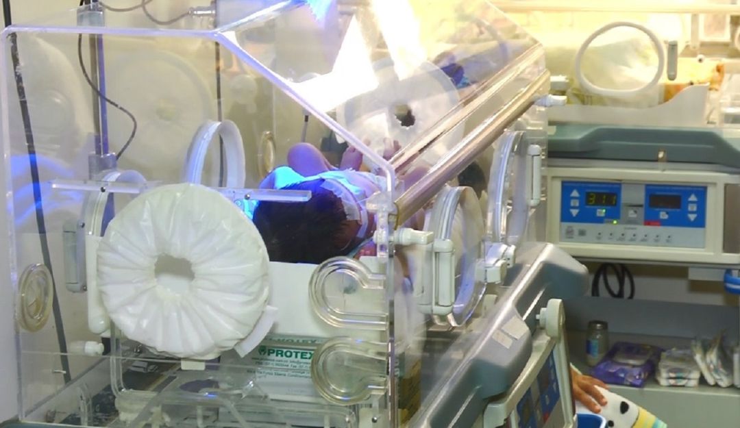 Madre con COVID dio a luz en coma: Médicos de la Versalles salvaron la vida a una madre con COVID y a su bebé