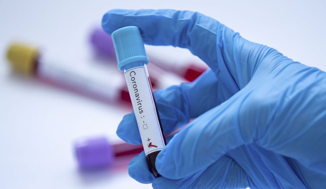 Coronavirus en Vaupés: Coronavirus cobra primera víctima en Vaupés