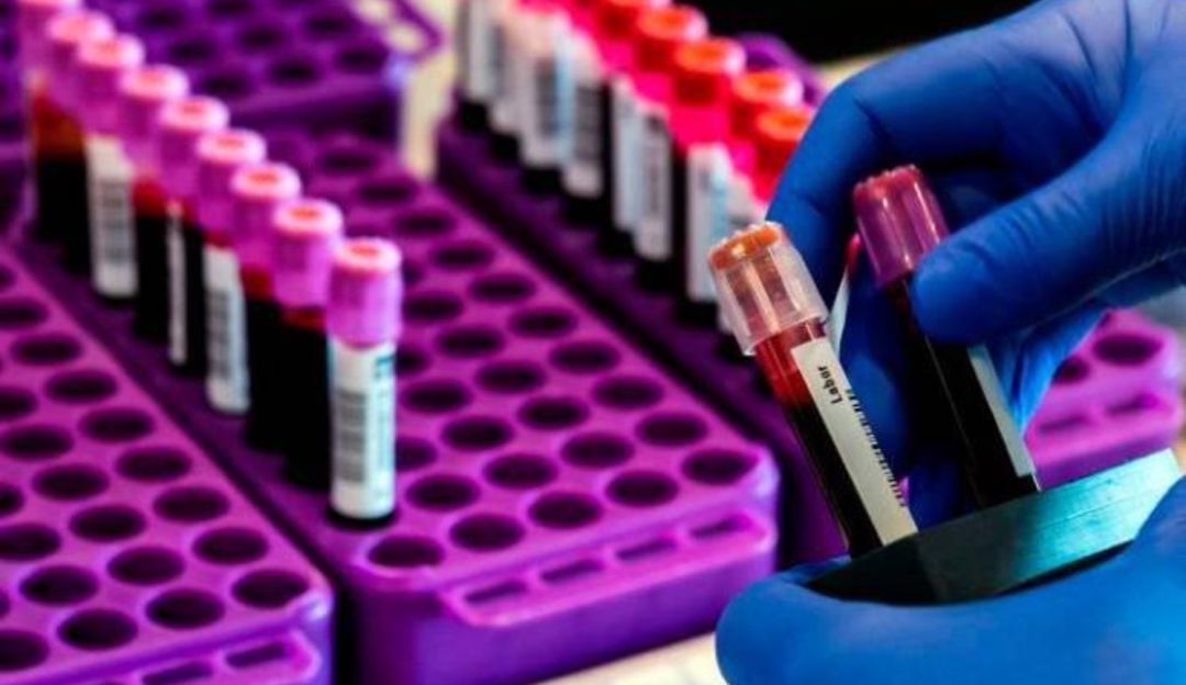 Profesional de salud es el primer caso de COVID-19 en Marsella, Risaralda
