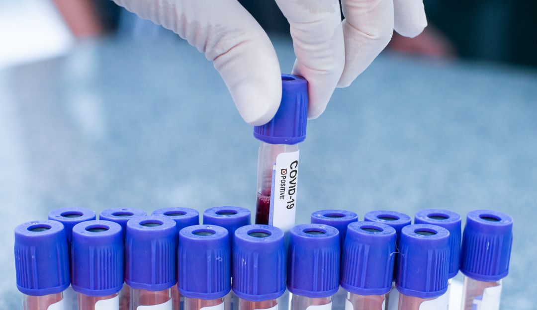 Coronavirus en Barranquilla: Atlántico registró el 45% de las muertes por COVID-19 en el país