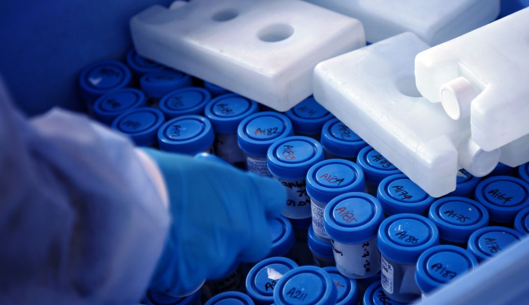 Muestras coronavirus: Se roban vehículo con muestras para COVID-19