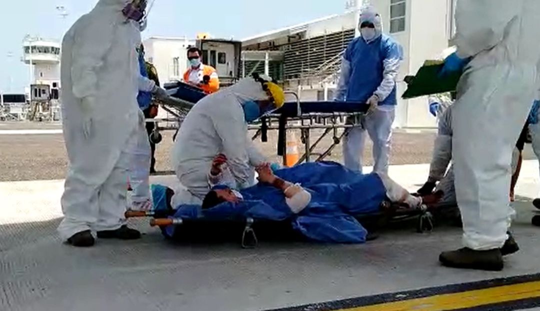 Explosión camión: Quemados en la tragedia de Tasajera serían sometidos a injertos de piel