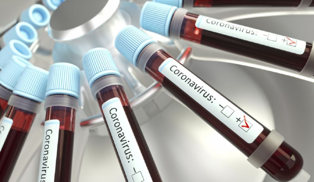 192 personas se han recuperado del COVID-19 en el Quindío
