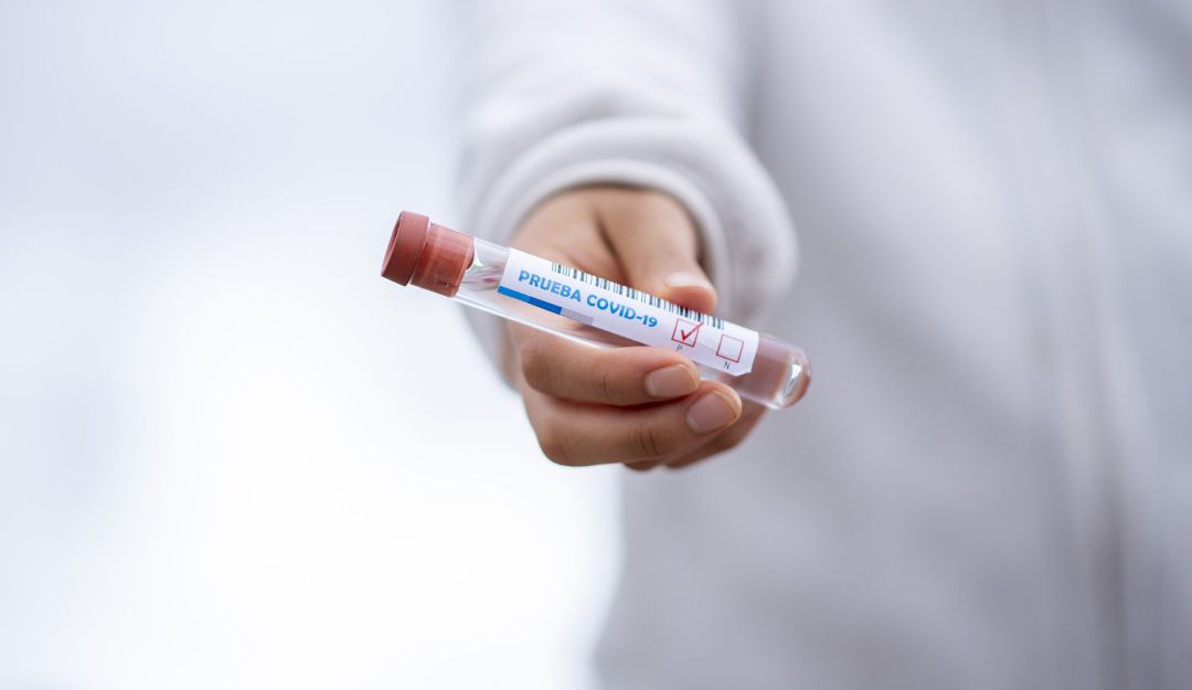 Vacuna contra el coronavirus: Vacuna contra COVID-19 probada en monos dio resultados alentadores