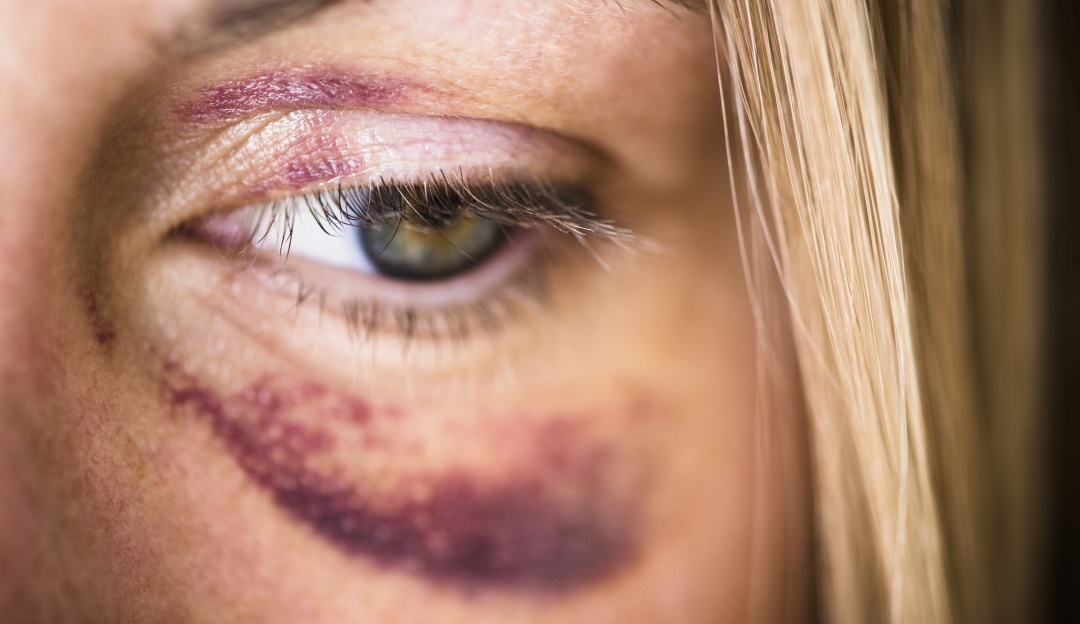 Maltrato mujer en Bogotá: El drama de las mujeres víctimas de violencia intrafamiliar en Soacha