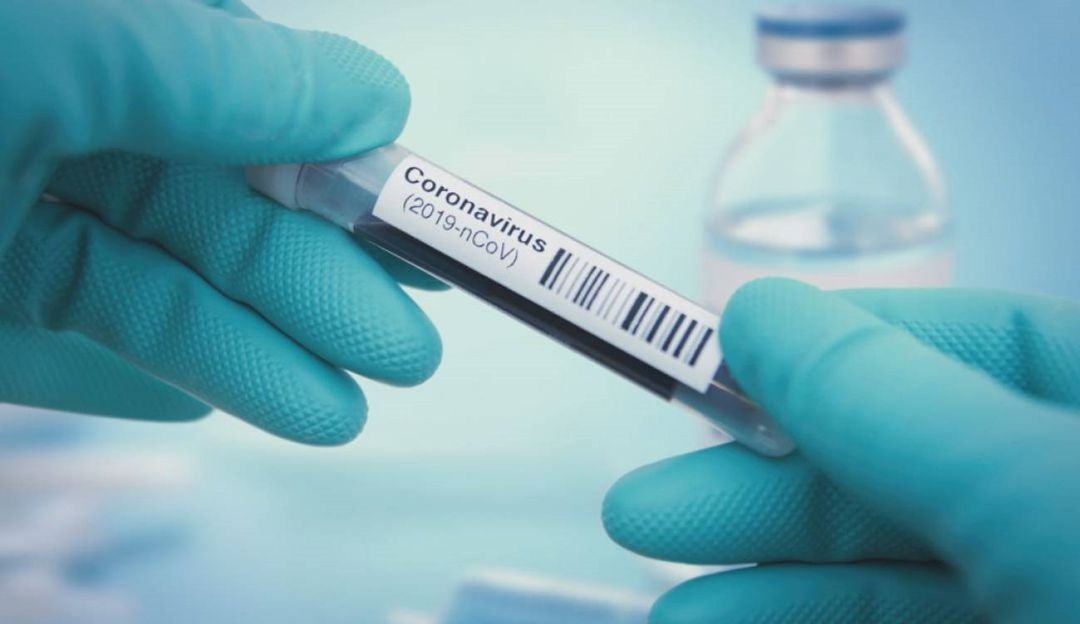 Aprobación vacuna coronavirus EE.UU.: EE.UU. iniciará proceso de aprobación de vacunas contra COVID-19 en octubre