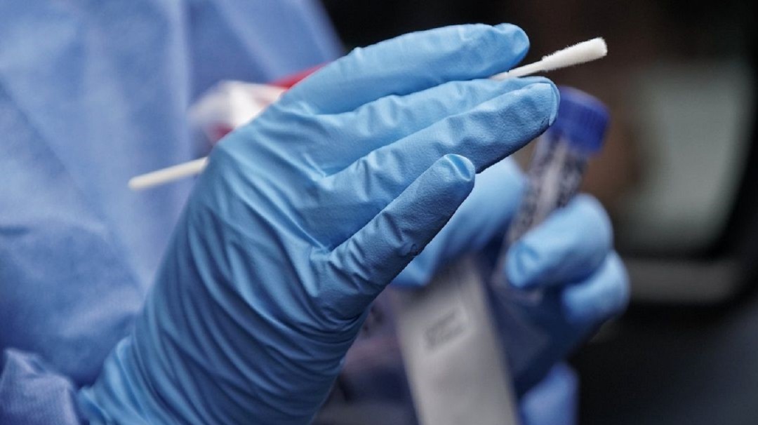29 muertos y 463 nuevos casos de coronavirus