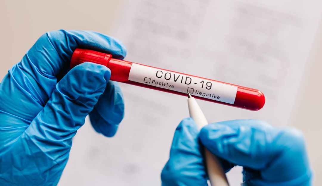 Coronavirus colombia: Conozca las razones por las que han bajado las pruebas PCR en Colombia