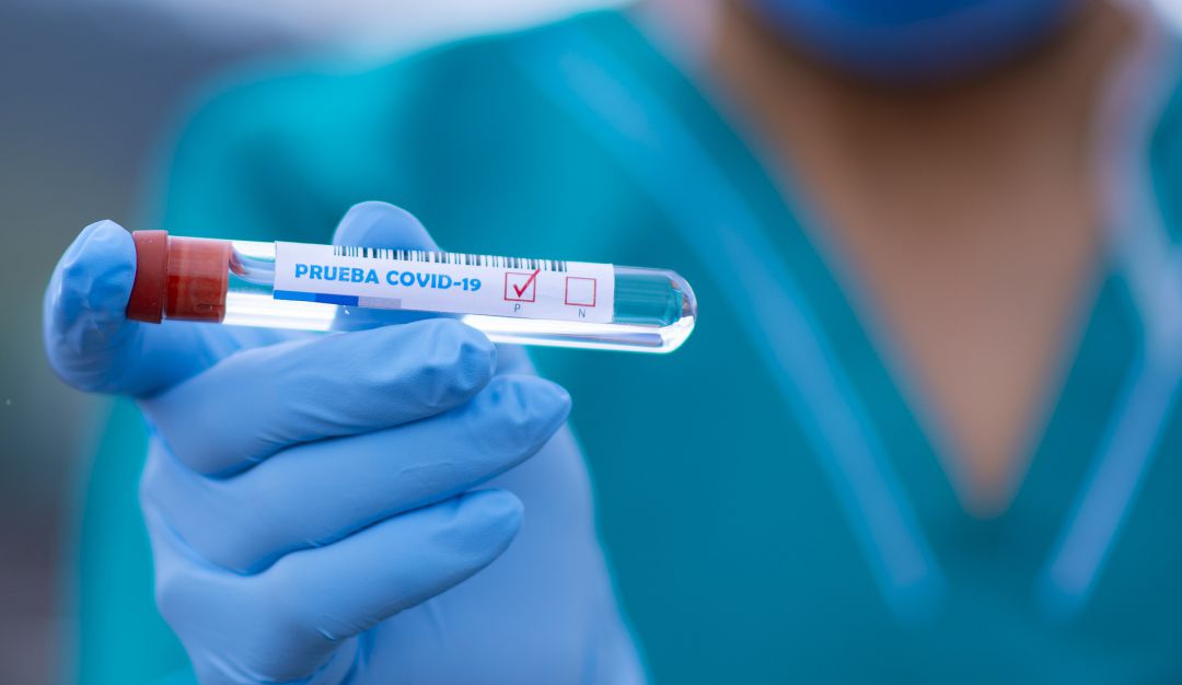 Pruebas COVID-19: Pruebas de COVID podrían haber detectado células inactivas del virus