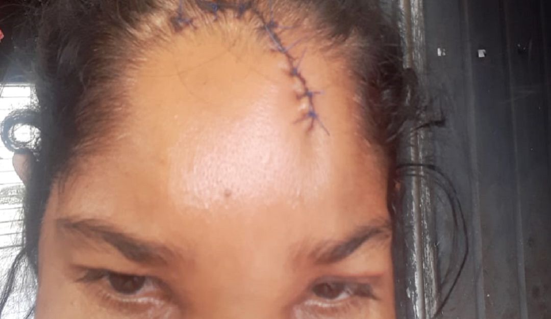 Abuso policial: Una mujer en Montería denunció que fue golpeada por un policía del Esmad