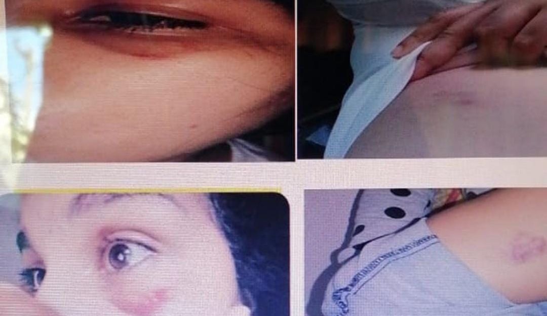 policia abuso de autoridad agresion mujer monteria cordoba: Abren investigación a policía que habría agredido a una mujer en Montería