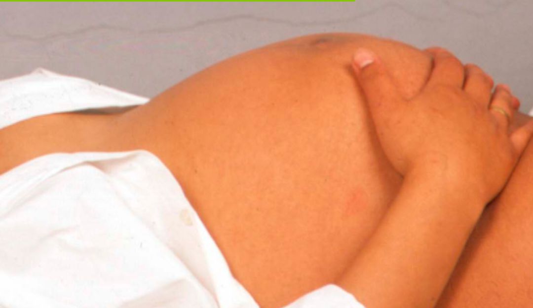 Embarazos adolescentes en Manizales por la pandemia: Embarazos adolescentes en Manizales han aumentado en tiempo de pandemia