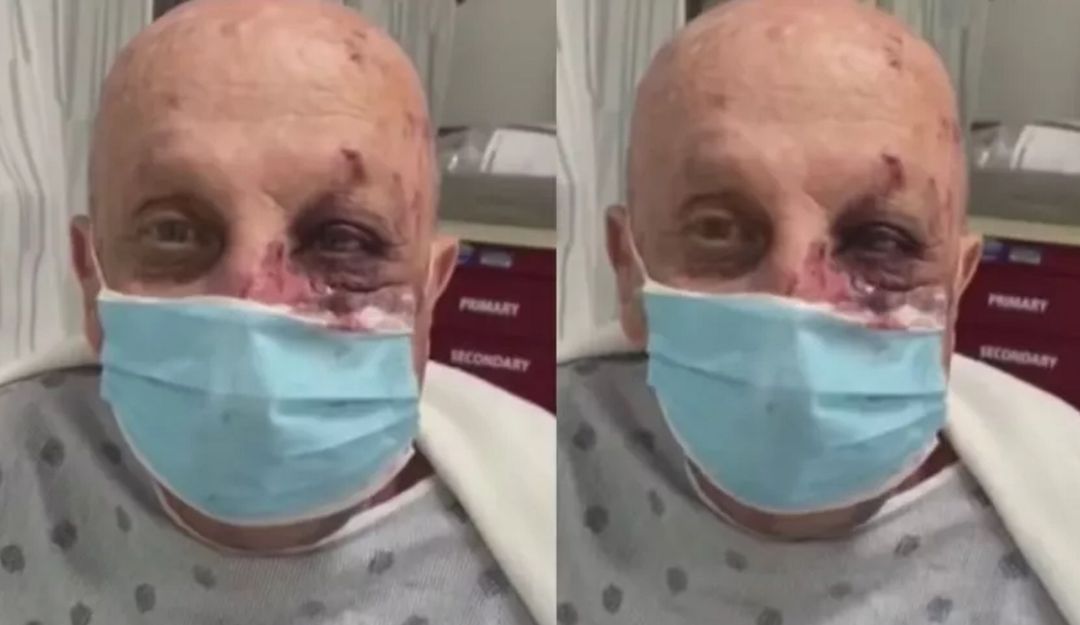 (VIDEO) Anciano es agredido en el metro de Miami: (VIDEO) Así fue agredido anciano por afroamericano en metro de Miami