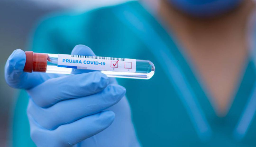Autoridades de salud en Antioquia temen un subregistro de casos de COVID-19