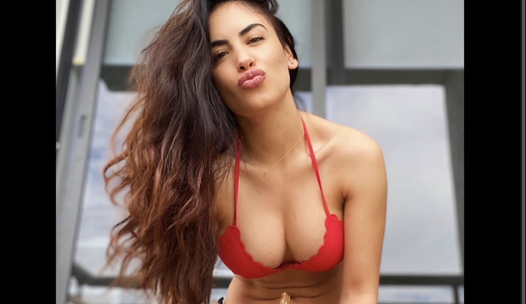 Jessica Cediel cirugía en la cola, biopolímeros: Con video Jessica Cediel mostró la cicatriz de su cirugía en los glúteos