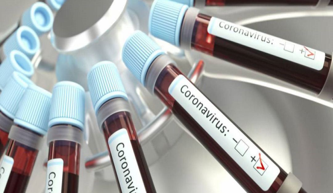 CORONAVIRUS: 2 muertos por COVID-19 en el Atlántico