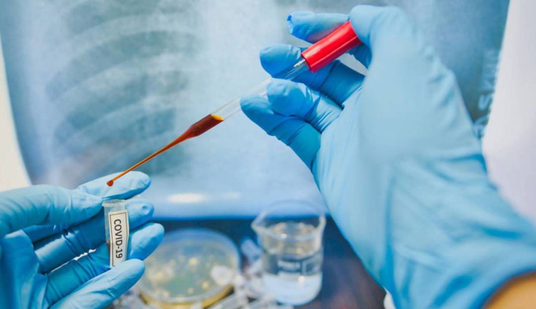 Coronavirus en Risaralda: Risaralda fue calificado con bajo desempeño en manejo de la pandemia