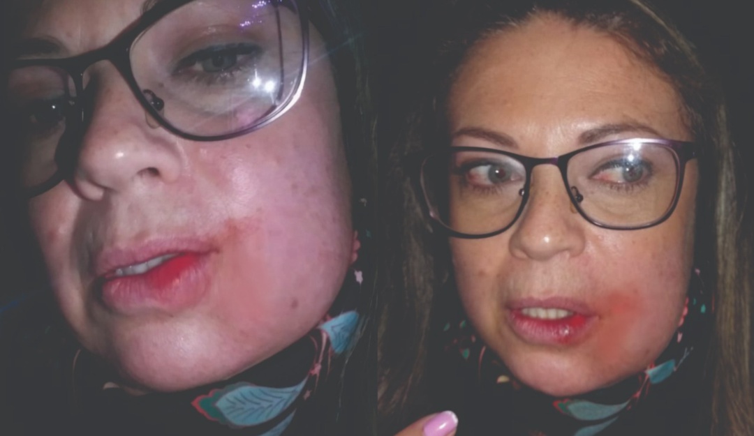 Concejal golpea mujer: Mujer denuncia agresión por concejal aparentemente borracho en Zipaquirá