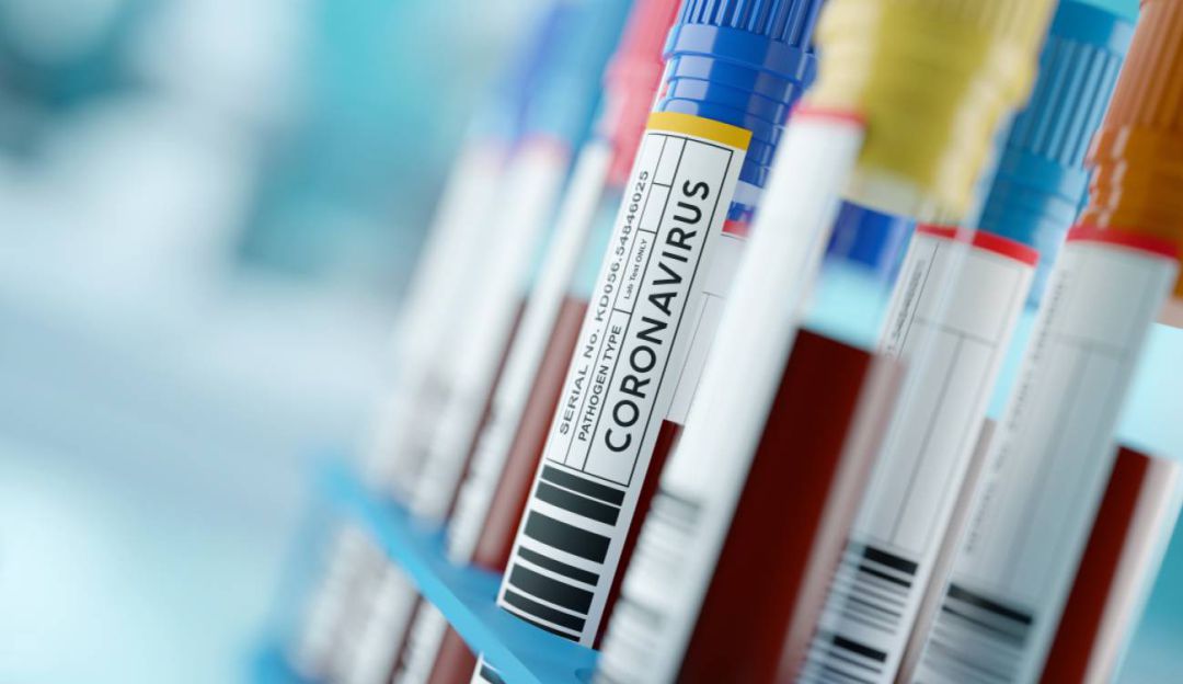 Personal de salud coronavirus: "Estigmatización hacia el personal de salud, el primer síntoma del COVID"