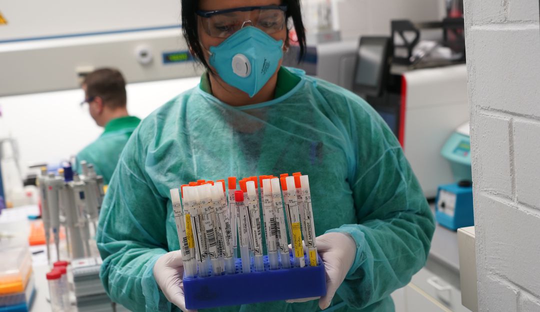 Coronavirus Vacuna Estados Unidos: Frenan estudio de anticuerpos contra COVID-19 de farmacéutica Eli Lilly