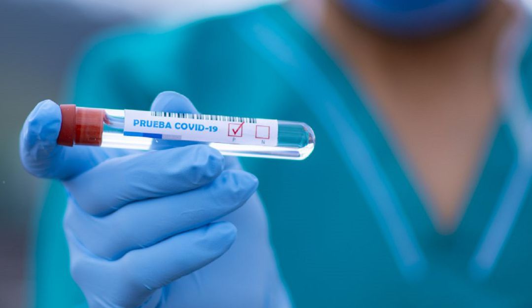 Pruebas COVID-19: Secretaría de Salud reconoce represamiento en pruebas COVID-19