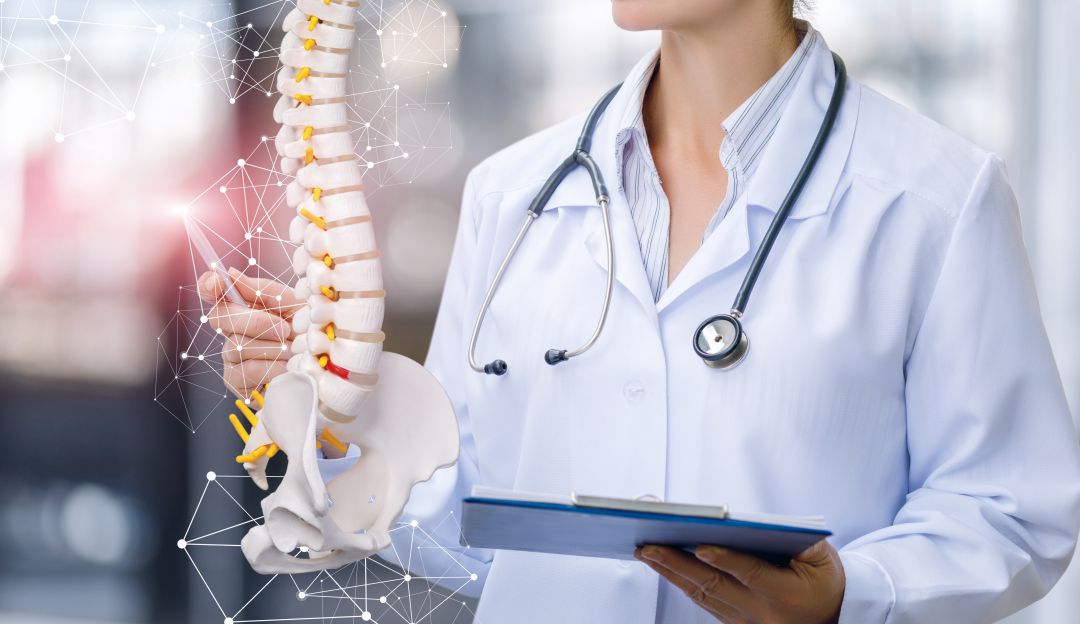 La Osteoporosis tiene gran impacto en la calidad de vida de los pacientes.