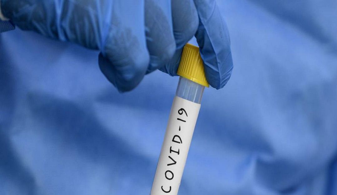 CORONAVIRUS: 2 muertos por COVID-19 en Barranquilla este sábado