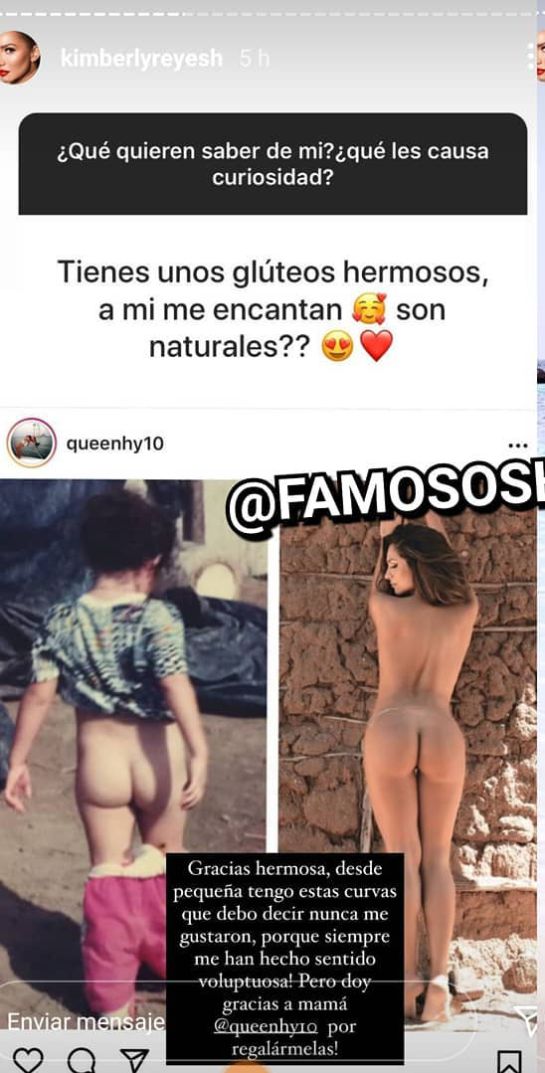 Kimberly Reyes y supuesta operación de cola: Con foto de su parte posterior, Kimberly Reyes habló de sus glúteos Kimberly Reyes y supuesta operación de cola: Con foto de su parte posterior, Kimberly Reyes habló de sus glúteos