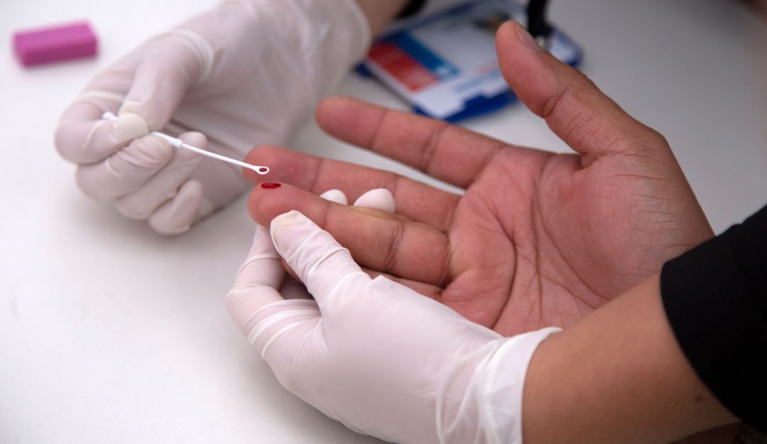 VIH SIDA Latinoamerica Organización Panamericana de Salud: Casos de VIH crecieron un 21% en Latinoamérica en los últimos 10 años