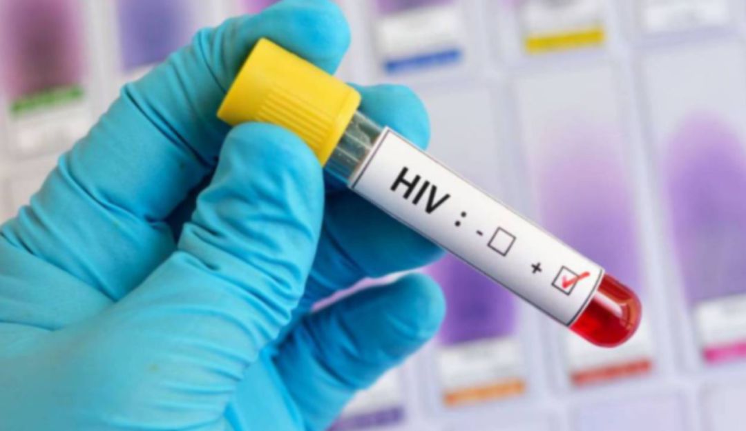 Detección de VIH en Caldas: Estado de pandemia afectó la detección de VIH en Caldas