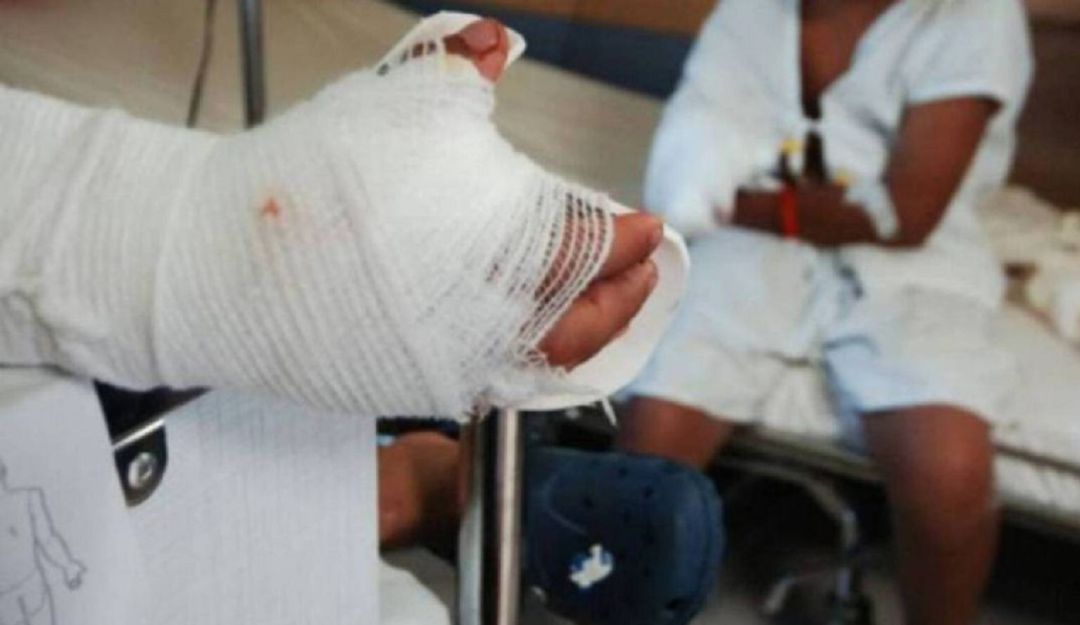 Noticias de Antioquia: En Año Nuevo, Antioquia registró 12 personas quemadas con pólvora