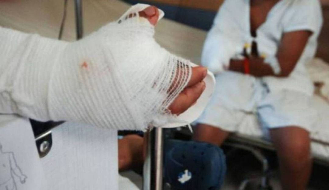 Quemados pólvora Bogotá velitas alumbrado: Van ocho quemados en Bogotá durante la noche de velitas