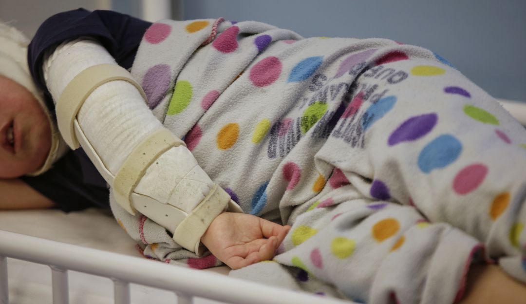 Día de velitas: Al menos 47 personas lesionadas por pólvora en la Noche de Velitas