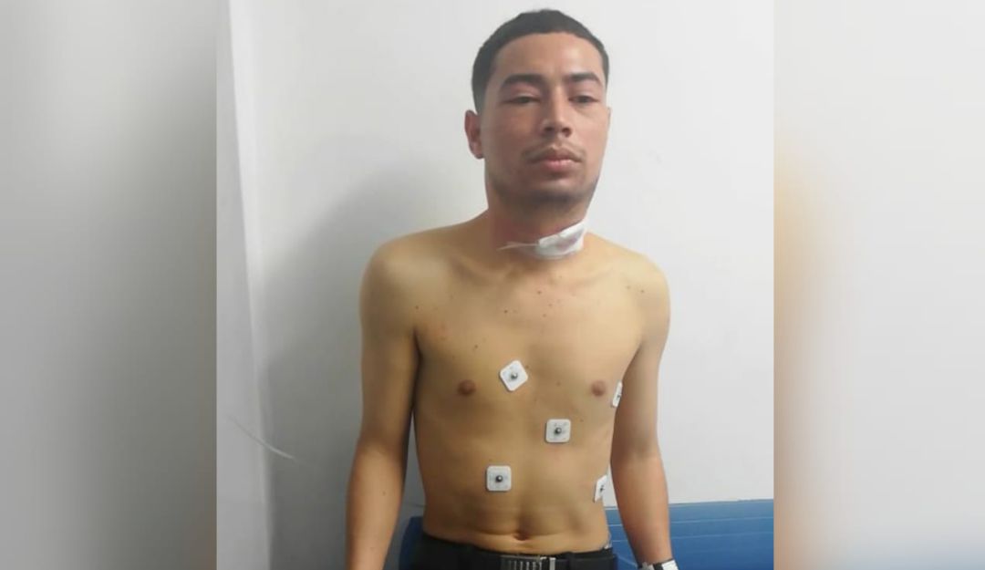 Feminicidio: Feminicidio en Las Flores: hombre mató a su esposa e intentó suicidarse