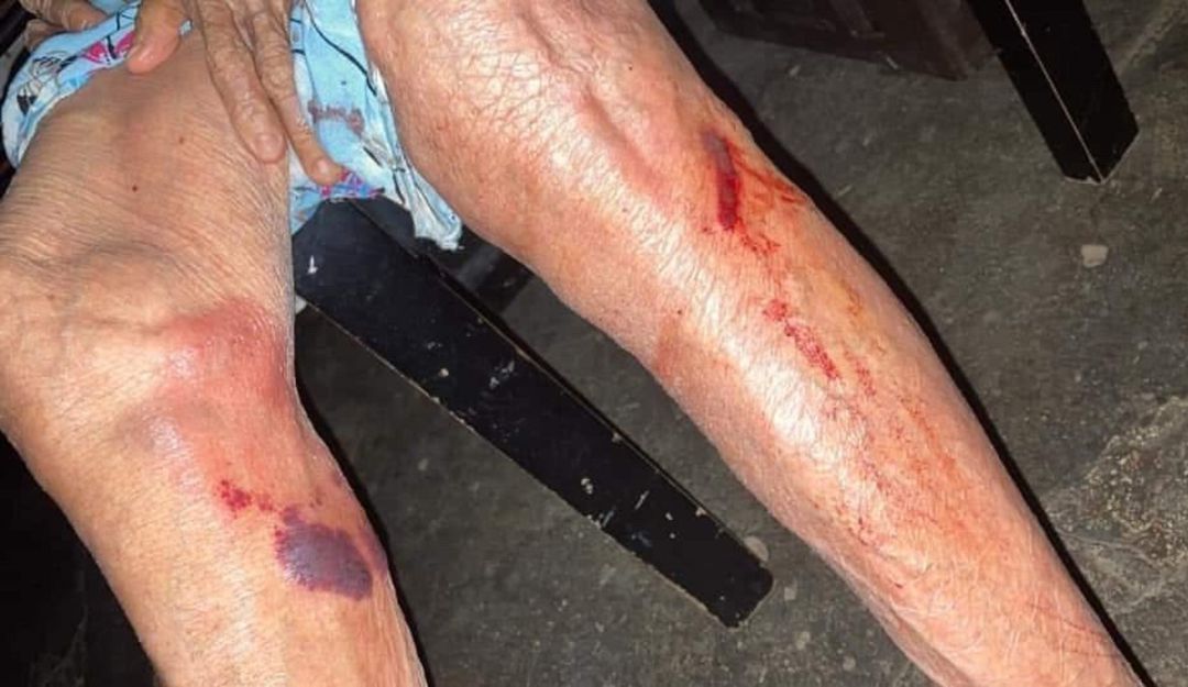 Maltrato contra adultos mayores: ¡Aberrante! En Santa Marta un hombre agrede físicamente a su abuela