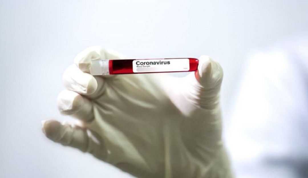 Coronavirus