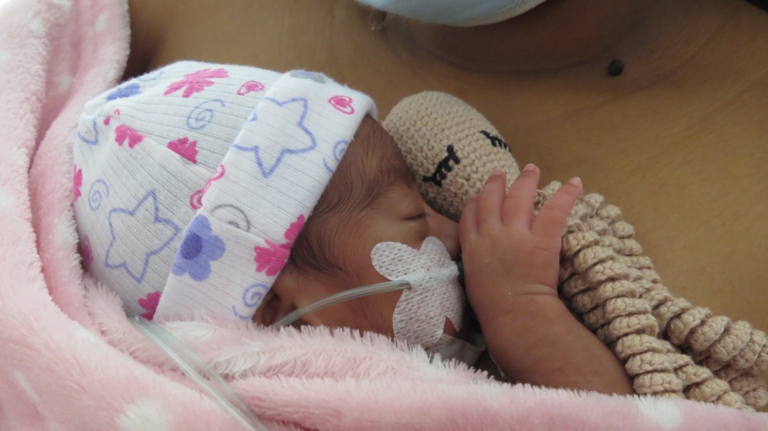 Pulpos terapéuticos para bebés prematuros en Hospital San Juan de Dios