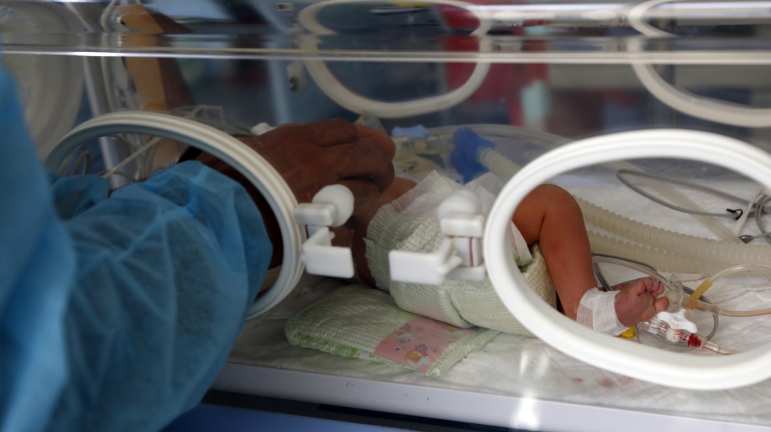 Confirman caso de mellizos con padres diferentes en Colombia