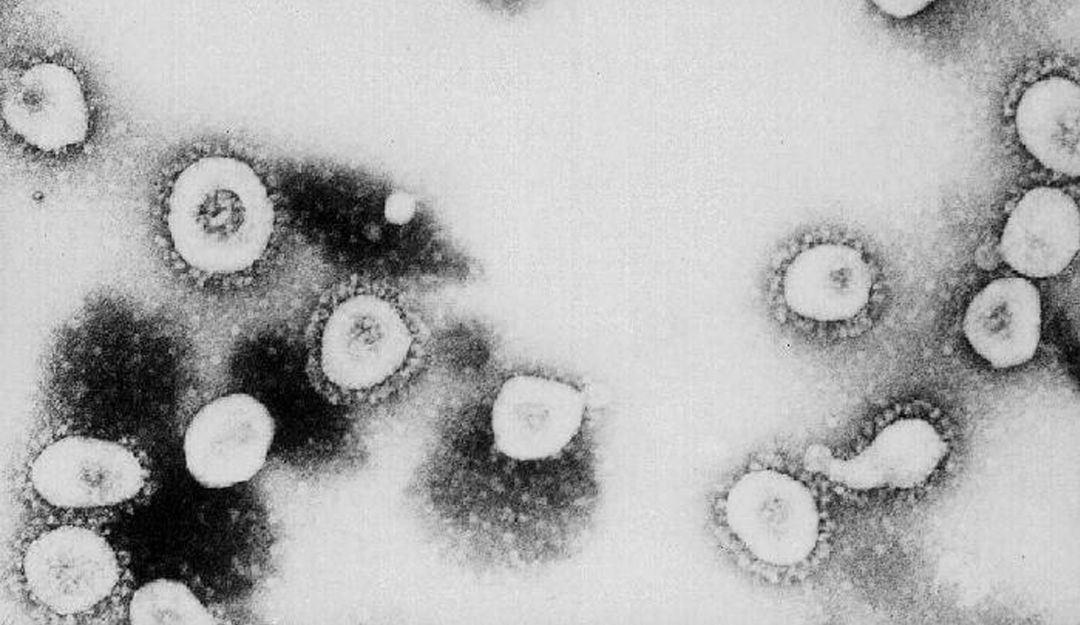 La estructura del coronavirus colapsaría al someterse al ultrasonido.