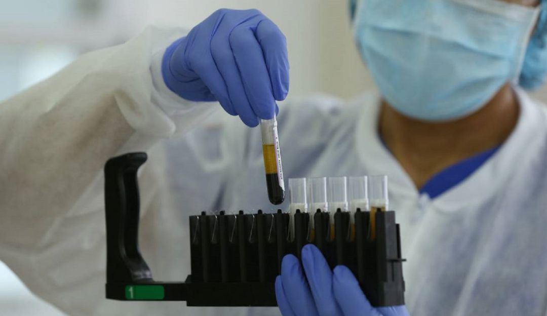 La cifra de pacientes fallecidos en Cartagena aumentó a 1.034