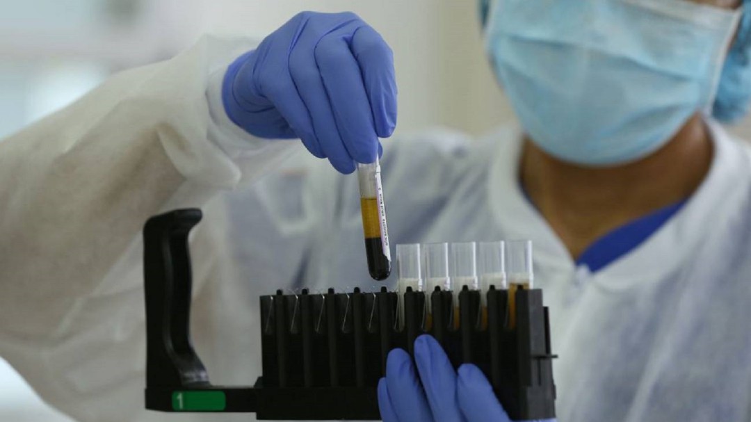Coronavirus en Cartagena: 83 nuevos casos y seis fallecidos