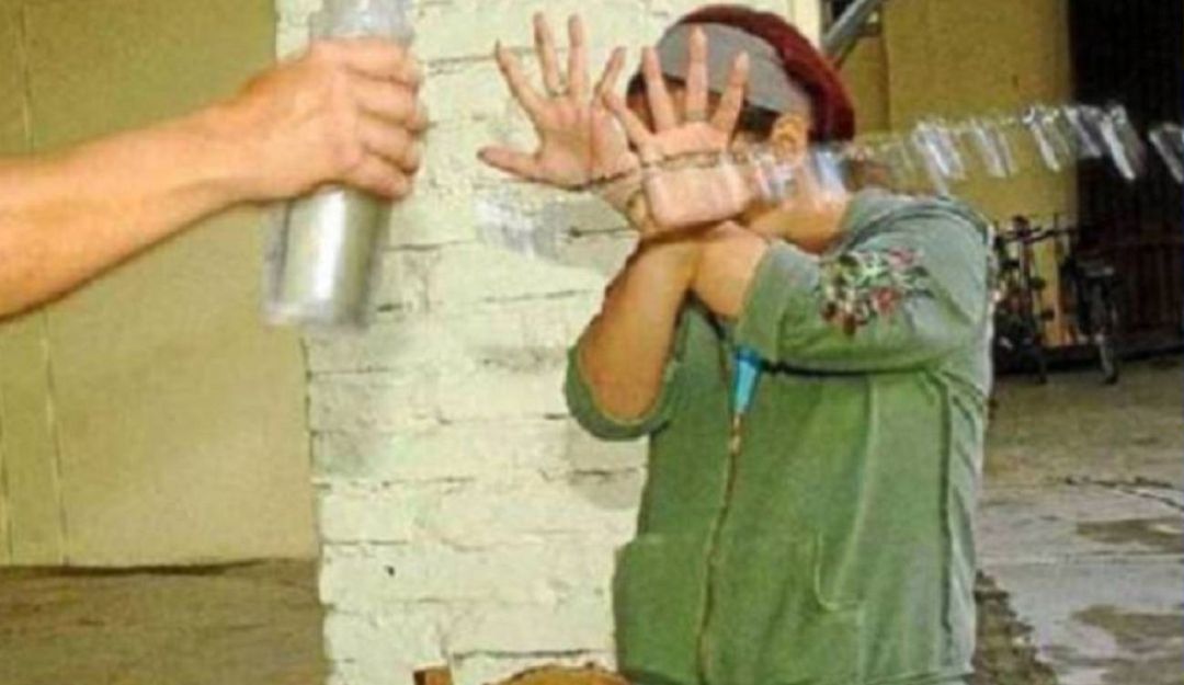 Ataque con ácido en Manizales. Foto: Colprensa.
