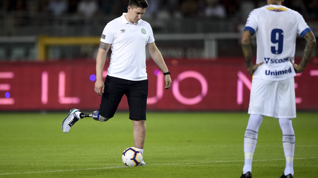 Un poco crúel: sobreviviente de Chapecoense se burló por su pierna amputada