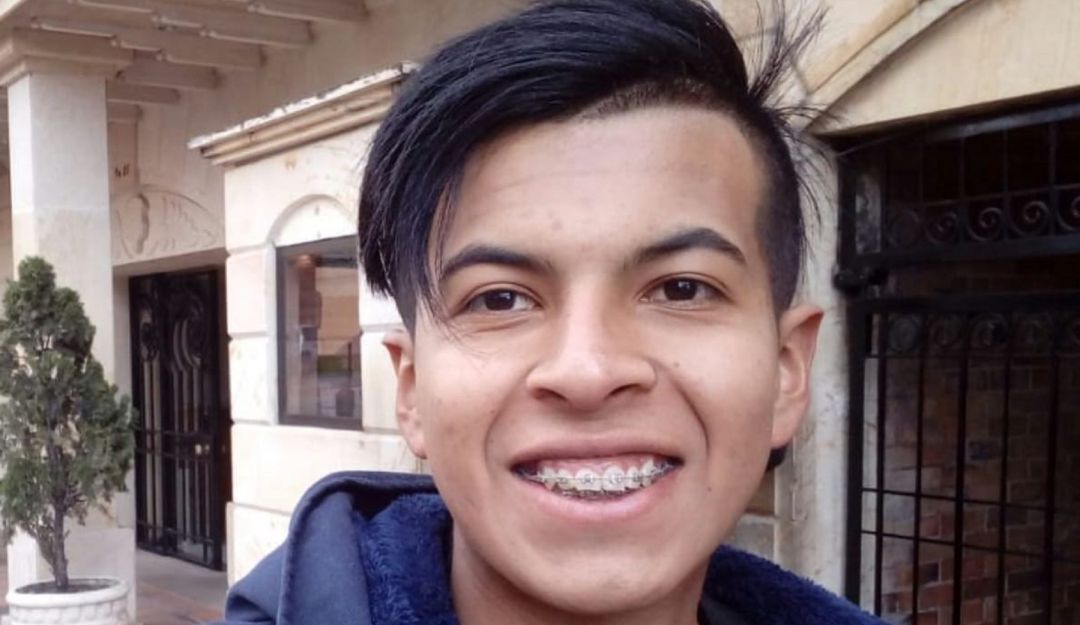 Juan Pablo Fonseca de 25 años, perdió un ojo en medio de manifestaciones