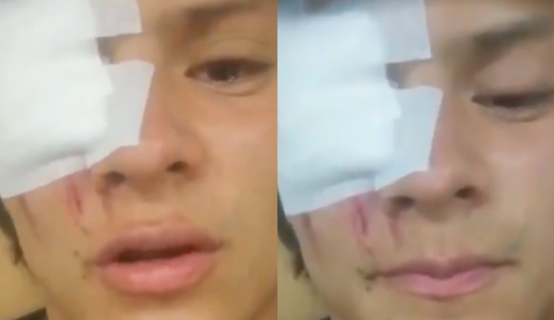Impactante video muestra cómo tanqueta del ESMAD atropelló a Juan Diego Impactante video muestra cómo tanqueta del ESMAD atropelló a Juan Diego