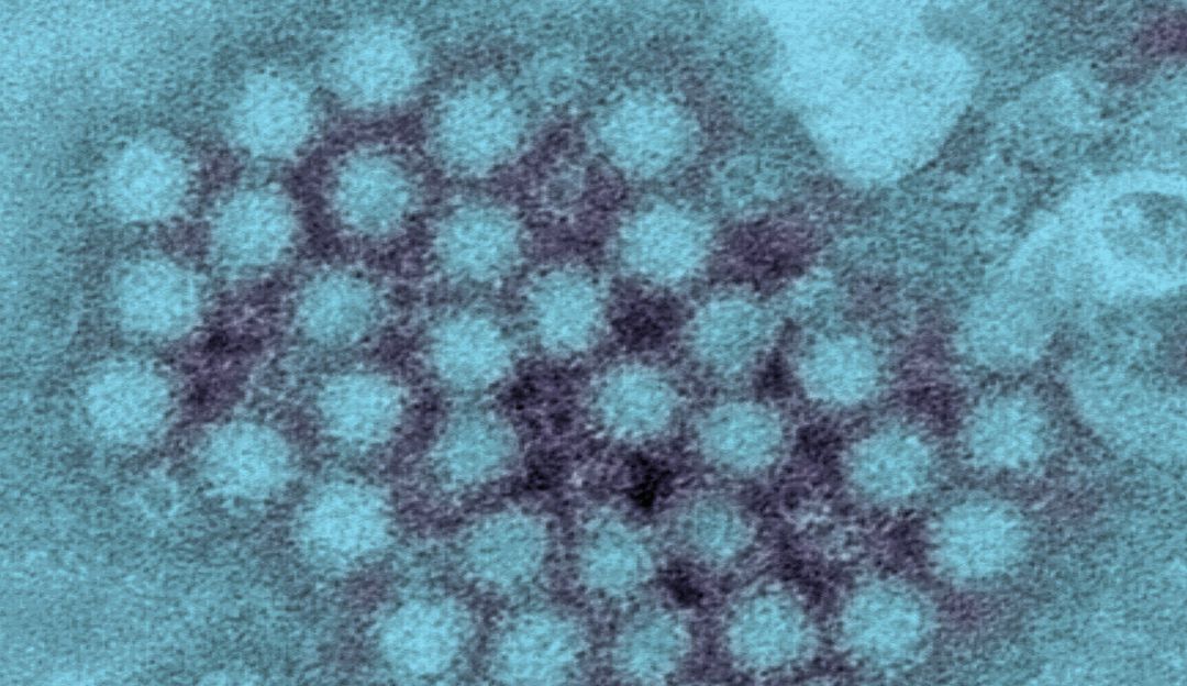 Norovirus Norovirus